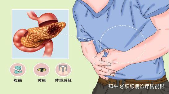 胰腺炎反射区的位置图图片