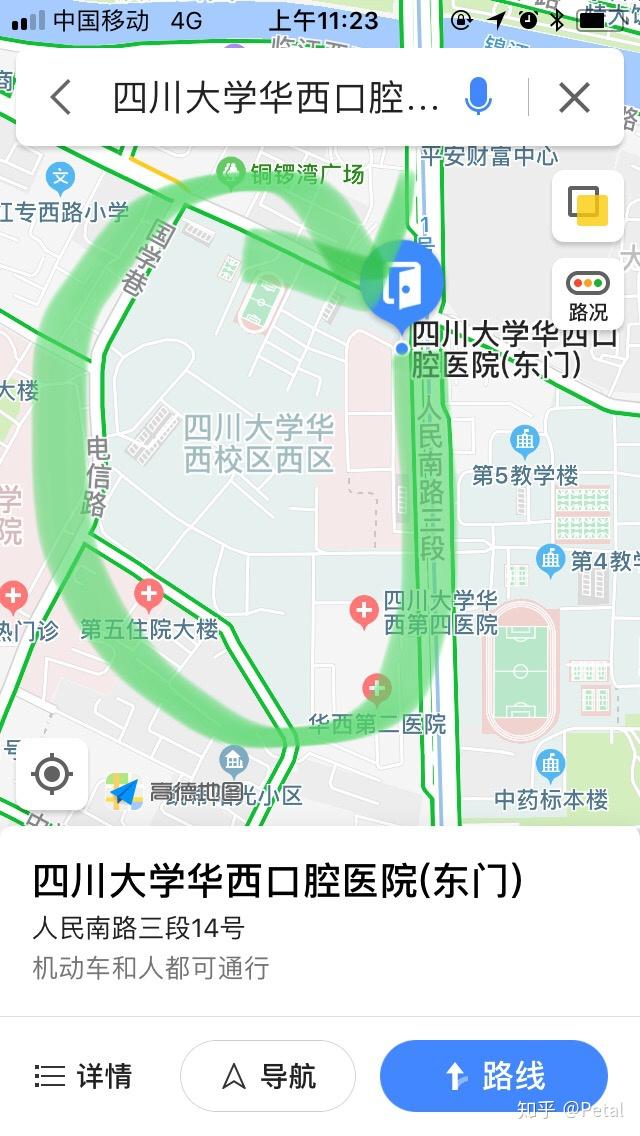 在四川大学华西口腔医院看牙做烤瓷牙是种什么样的体验 