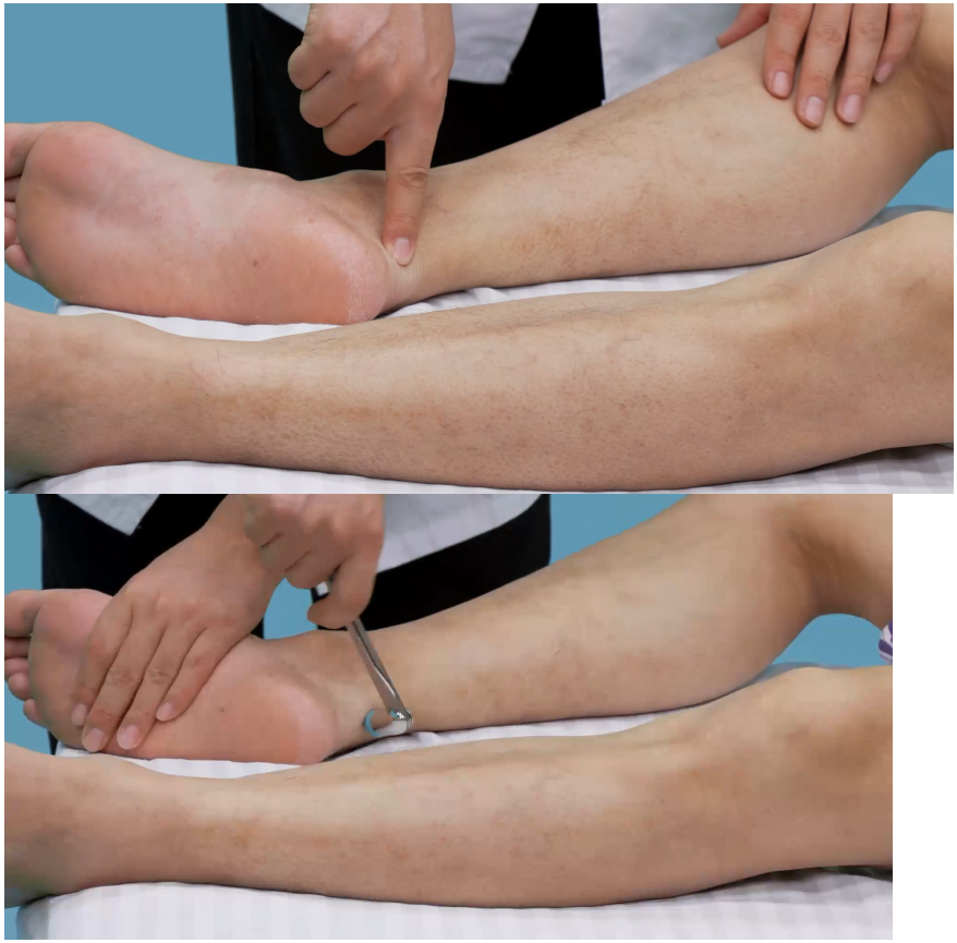 执业医师考试:体格检查-杂项04:神经系统查体