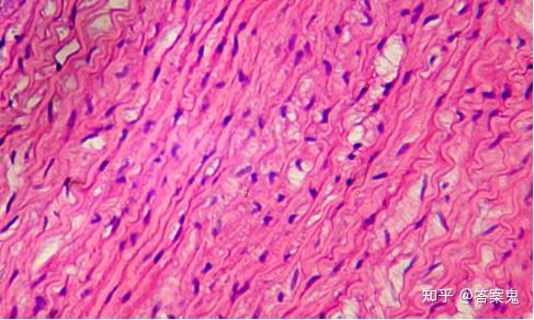 图8-4大动脉(大动脉横切 he染色10×10) 大动脉的内膜(a)的内弹性膜不