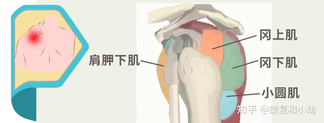 11去醫院檢查後發現為左肩肱骨大結節骨折,遂根據醫囑居家功能訓練