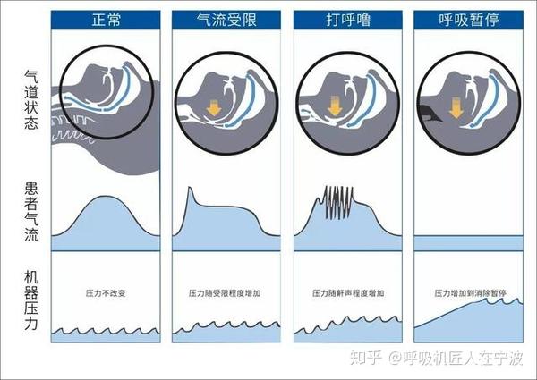 匠人独家：详解全自动呼吸机！