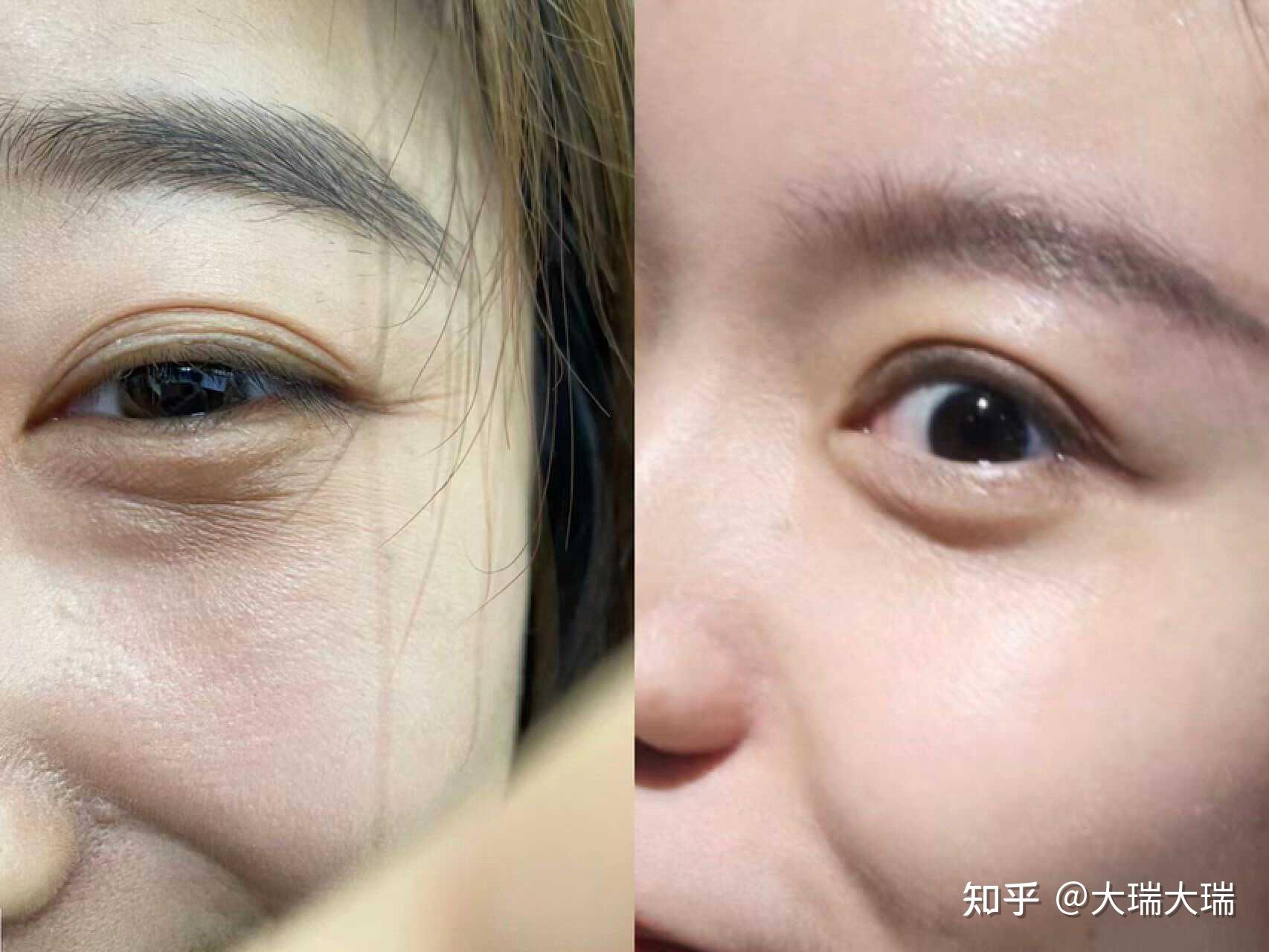 化妆不是解决眼袋眼纹泪沟问题的唯一方法,美容仪才是关键! - 知乎