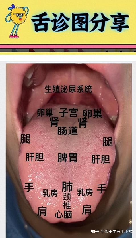 2分钟学会中医舌诊技巧,看病不求人,赶快收藏! - 知乎