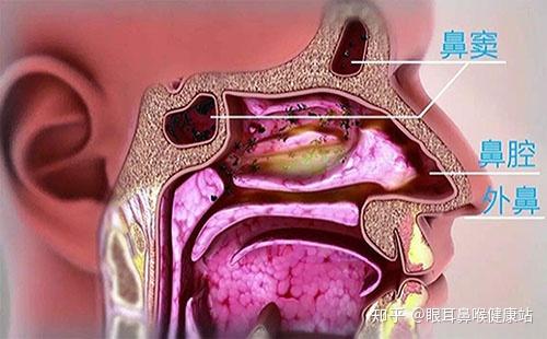 首大陈潜:鼻子经常堵塞是什么原因 - 知乎