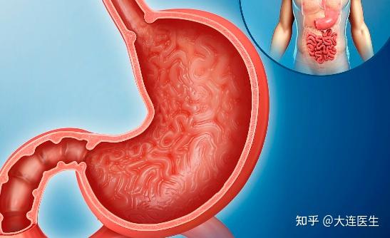 急性胃炎和慢性胃炎,你分得清吗? - 知乎