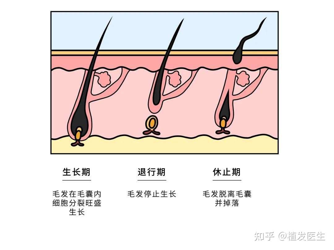 普拉朵植发丨你了解毛发有哪些类型吗? - 知乎
