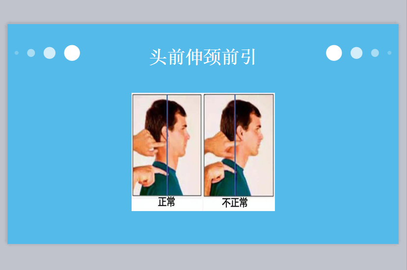 含胸驼背如何自我矫正？完整分析和康复方案。 - 知乎