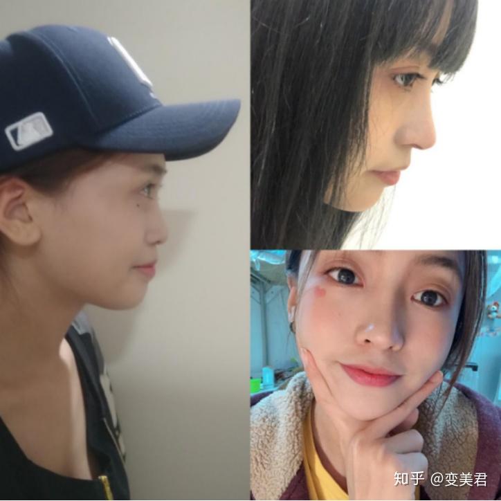 怎么拥有高粱鼻 v2-f1be1105e090773ea3876a2dcb1a07e6_r.jpg