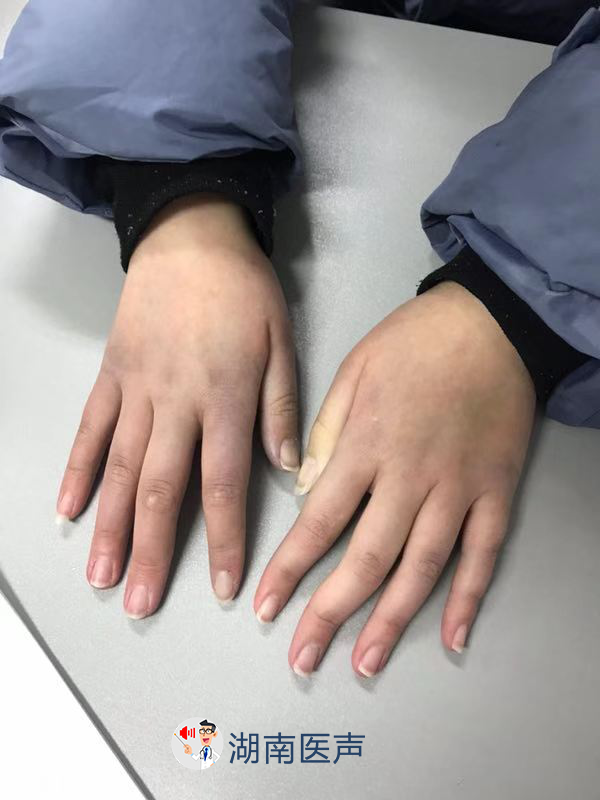 女子为美导致手冻伤，医生：保暖要注意这几个地方！ - 知乎