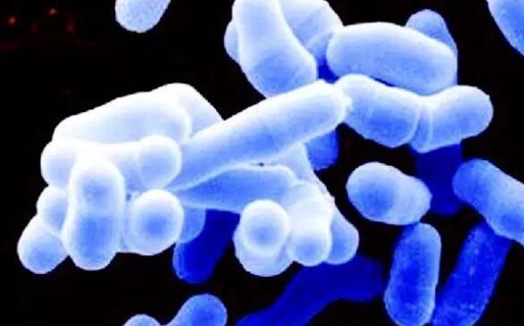 创伤弧菌也可通过伤口感染但黄博士提醒,食源性创伤弧菌感染还有另外