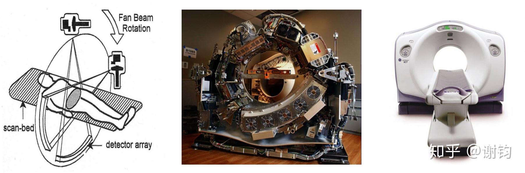 现代医学成像(3)——CT(基本原理与图像重建) - 知乎