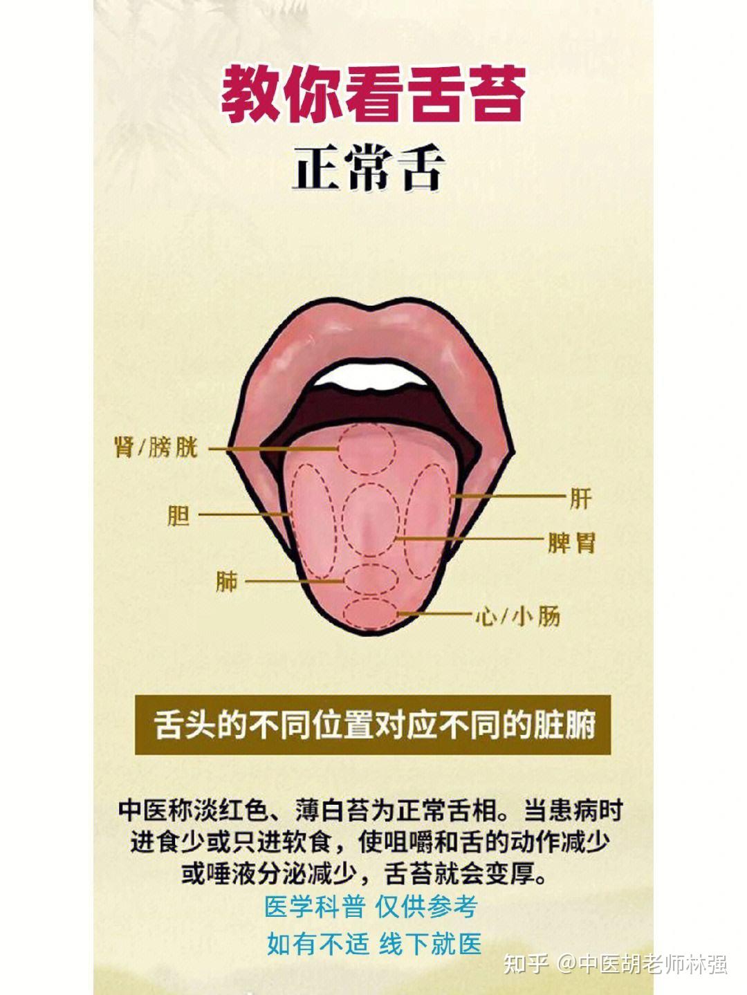 舌头边缘有齿痕?不一定是脾虚湿气重,中医教你三招解决齿痕舌 - 知乎