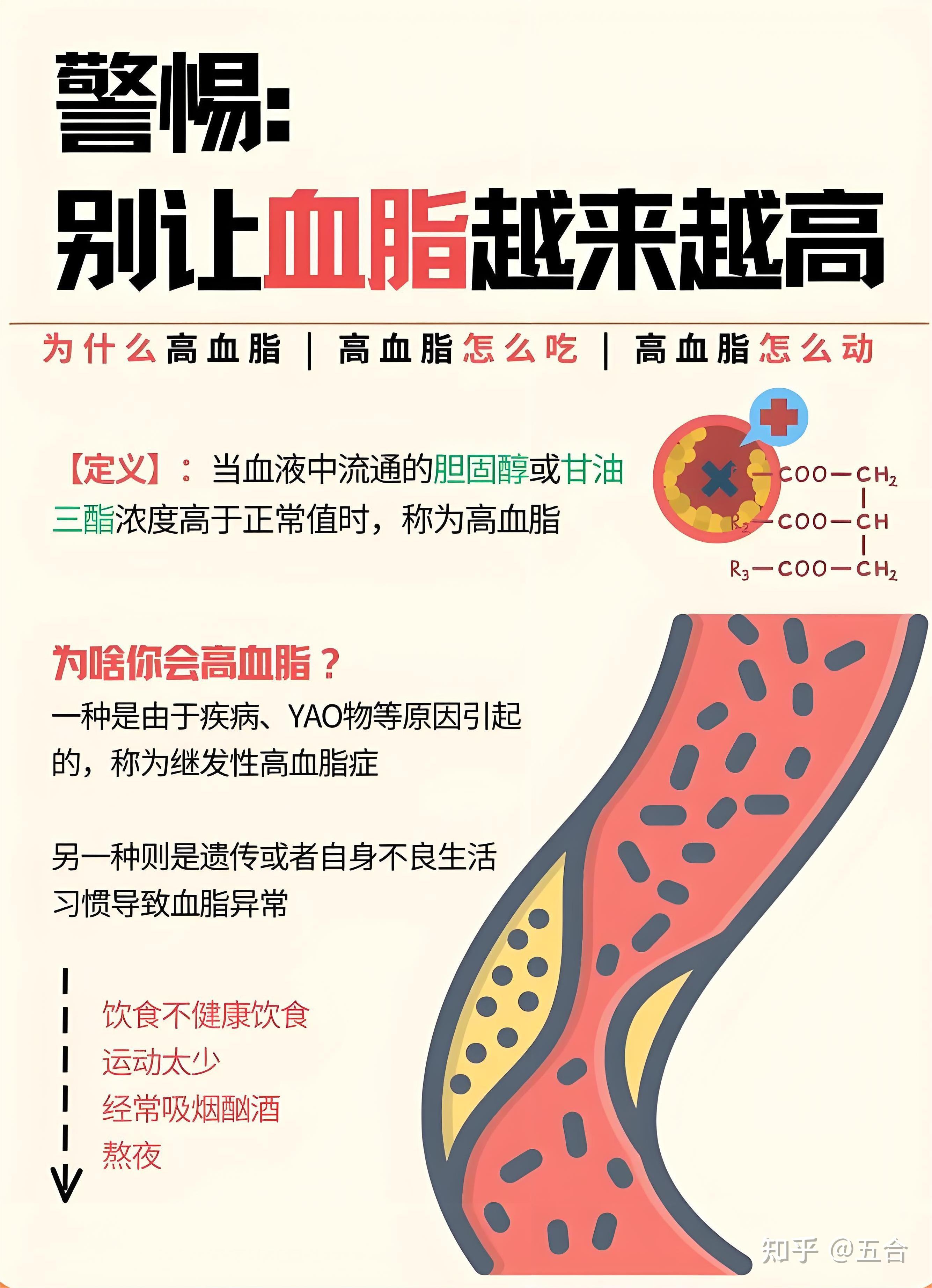 高血脂到底有多可怕?吃什么降血脂快? - 知乎