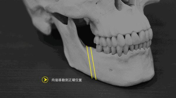 不用花费大量的人力物力财力去做正颌;图源网络,侵删但若真是颌骨问题