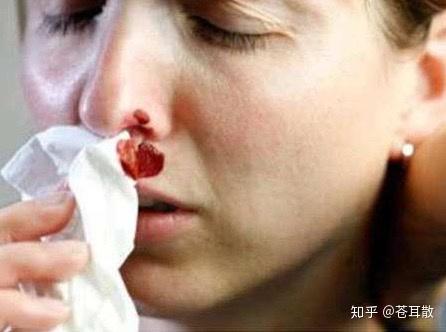 冬季过敏性鼻炎反复发作 教你一套鼻子健身操 有效预防鼻炎 知乎