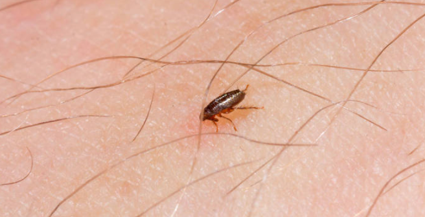 草地露营时,钻进你身体的虫子有多恐怖?