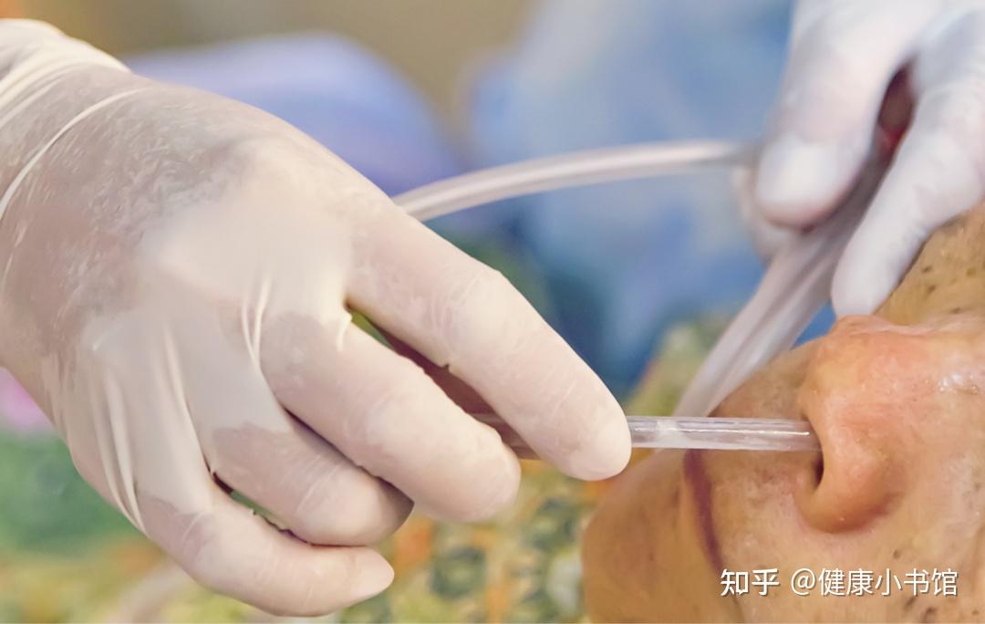 胃管的插入深度是从鼻尖到耳垂再到患者剑突的长度.