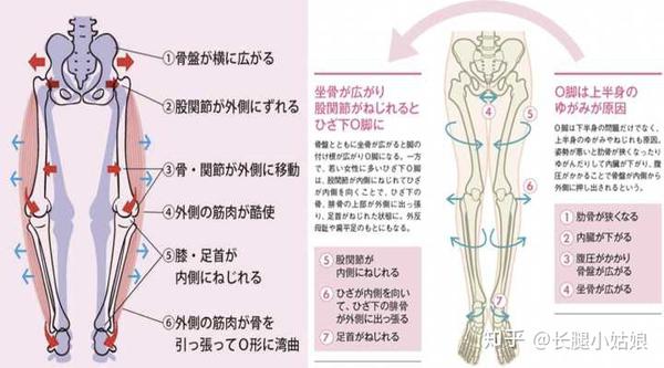 什么是xo型腿 Xo型腿如何锻炼 按摩矫正 如何细 直小腿 看这一篇就够了 知乎
