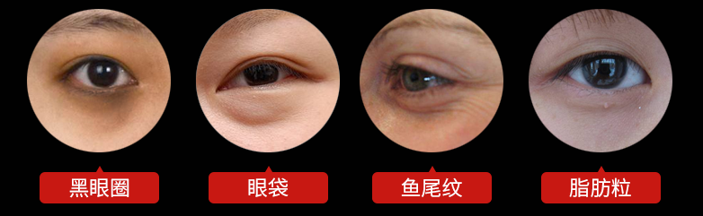 关于眼周问题与眼霜你知道多少
