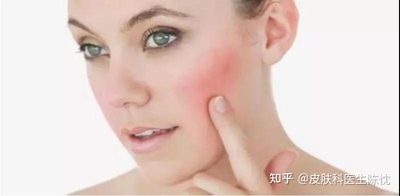 湿敷效果这么好,要面膜干啥?! - 知乎
