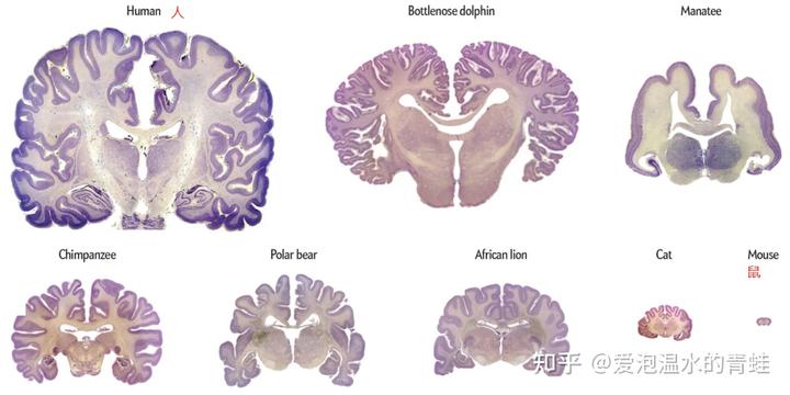 为什么人与人之间的智商不同?大脑结构有差异吗? 4 v2 f39a7236e78c5ad26836d84c55ce66cb 720w