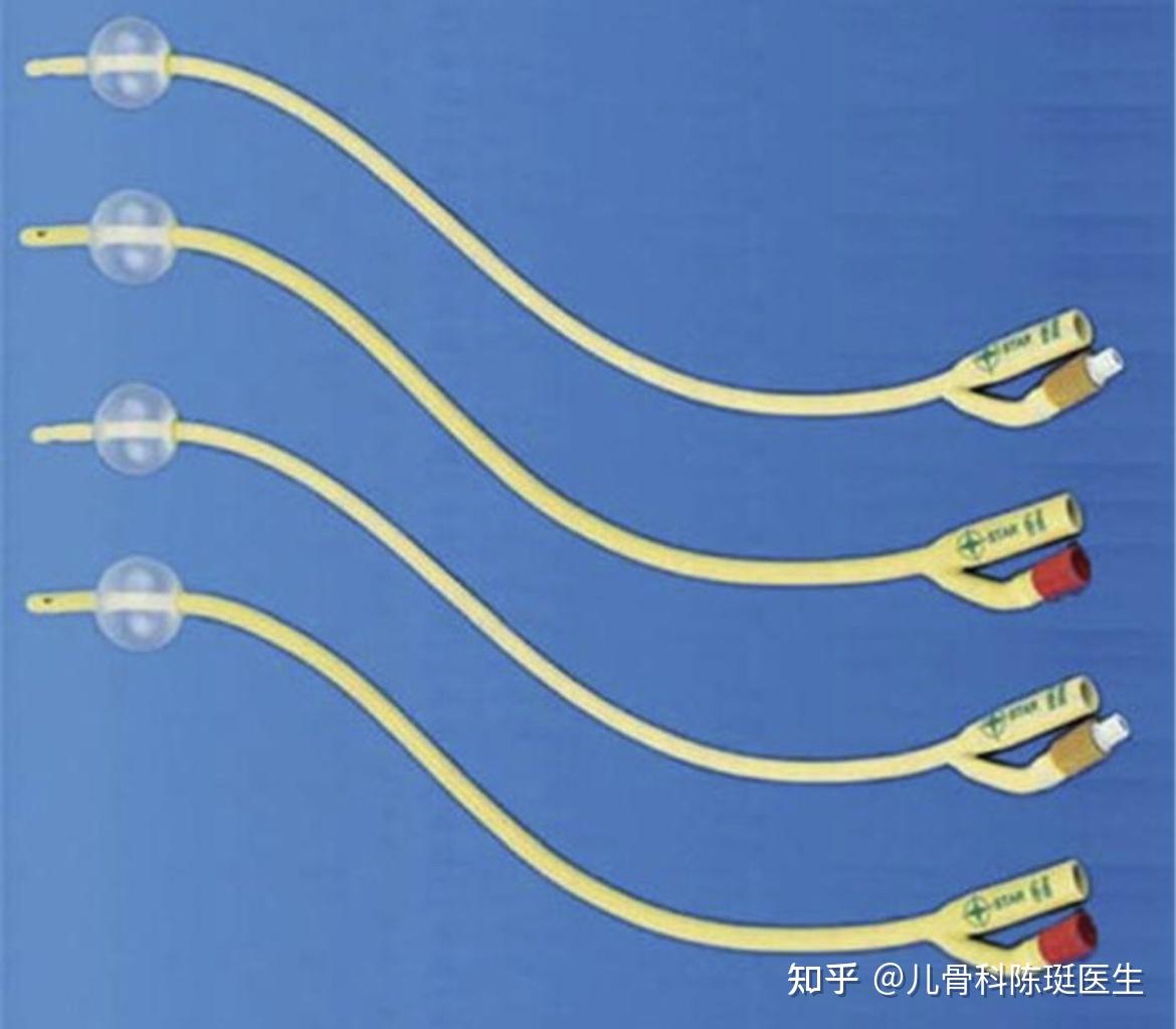 孩子手術治療中留置了導尿管這護理技巧家長們瞭解多少