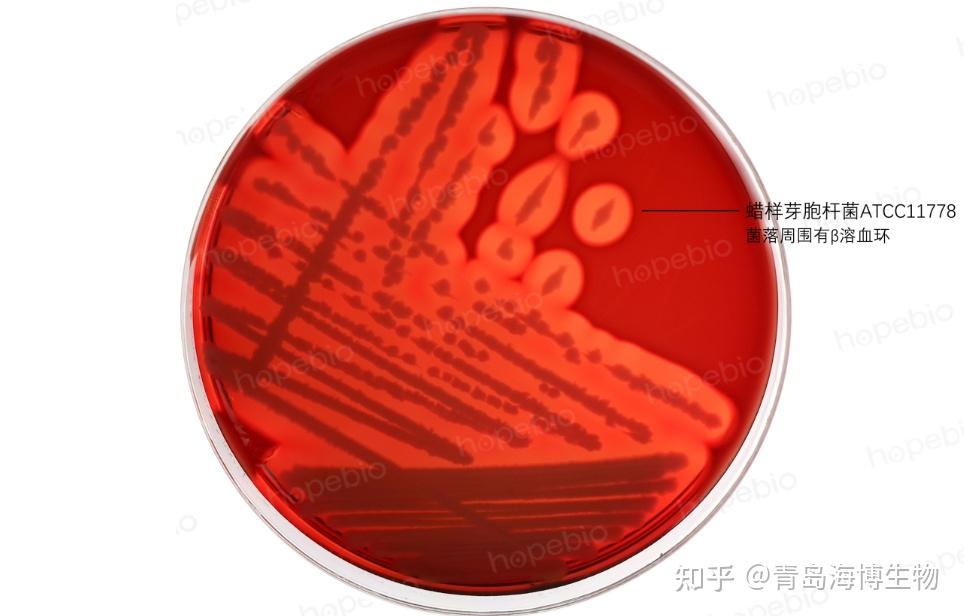 细菌溶血试验原理及现象 - 知乎