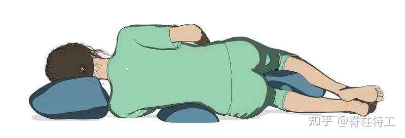 脊柱侧弯怎么睡最佳睡姿vs最差睡姿