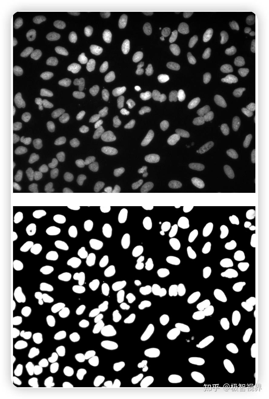 3d pytorch 3dunet 3d 