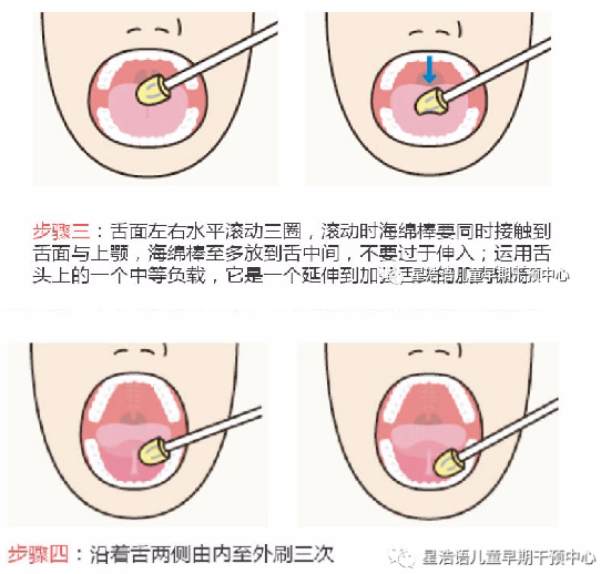 发育迟缓儿童口肌训练实用方法