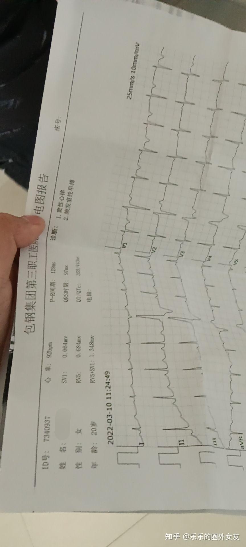 你是怎么检查出抑郁症的? - 知乎