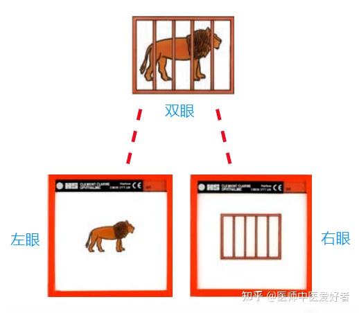 你了解同视机吗