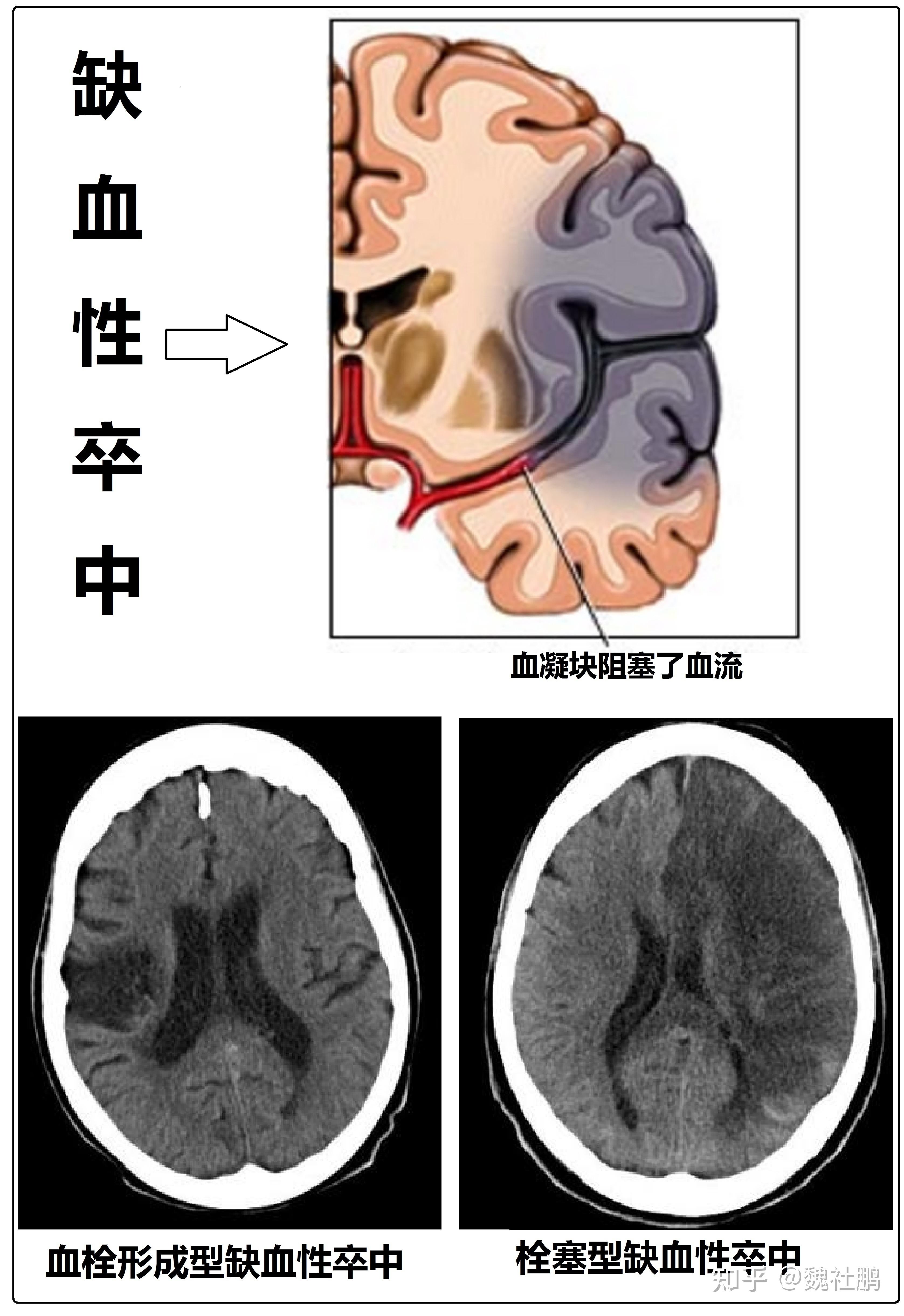 影像检查或尸检发现的