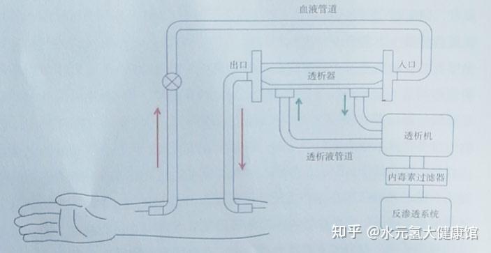 富氢血液和腹膜透析的六大医学作用