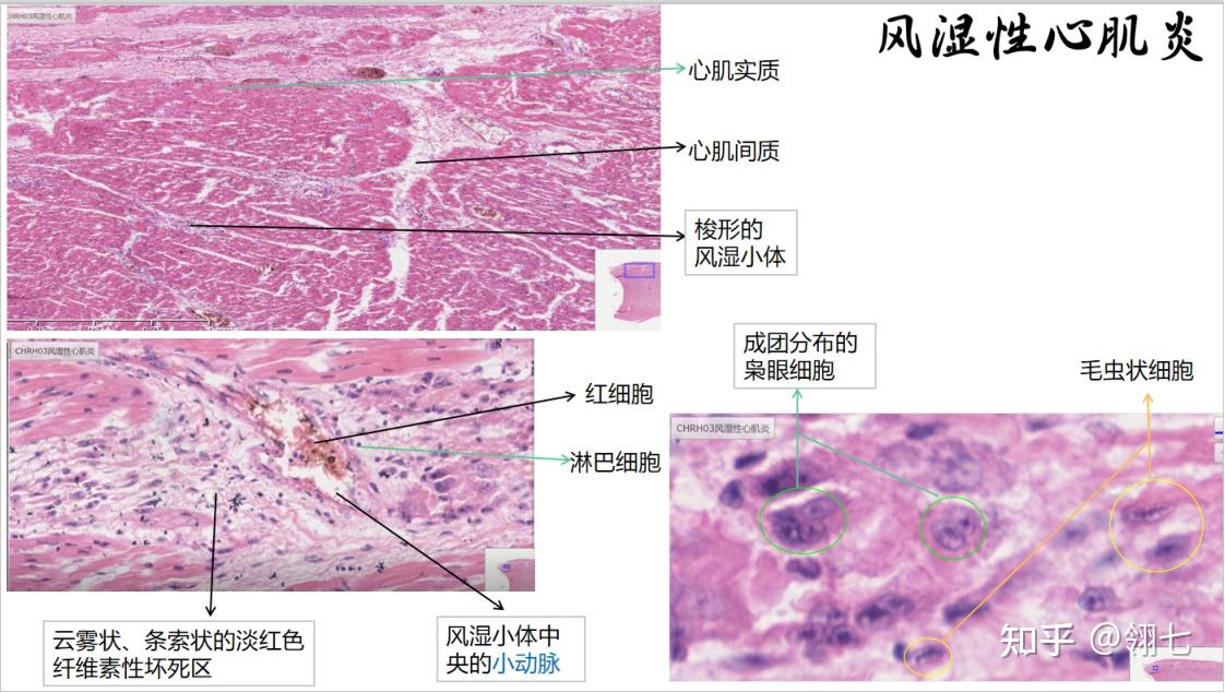 心肌纵断面图片