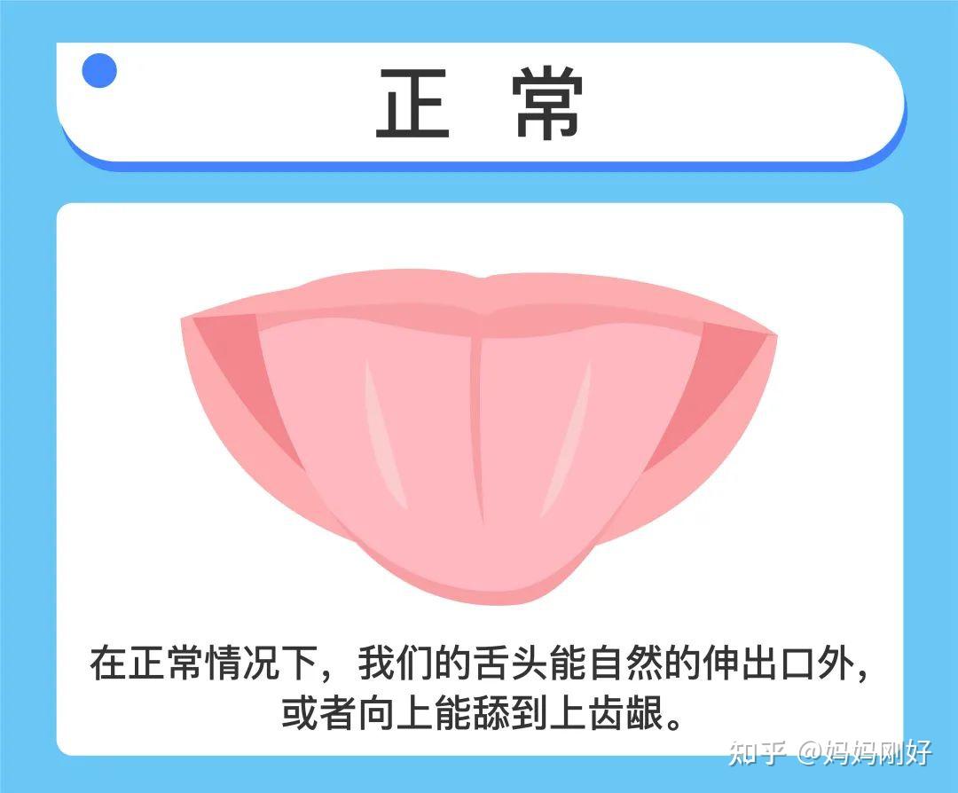 舌根没剪说话不利索别用你的无知害惨了孩子