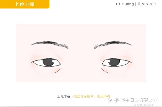 你的眼睛为什么看起来那么凶 三角眼该怎么办 知乎