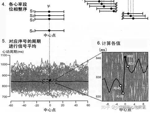 心率减速力检测的临床意义 知乎