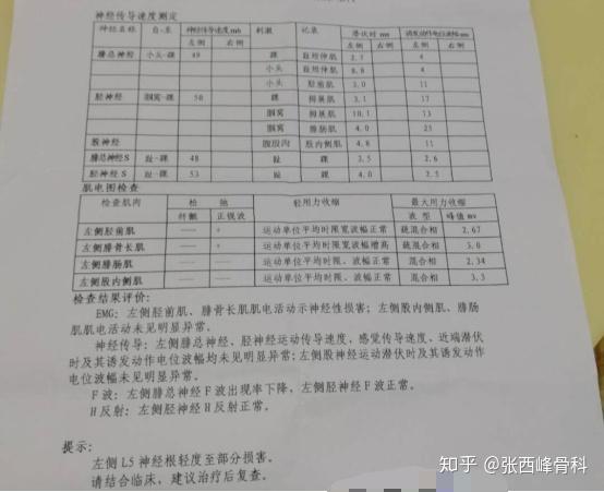 该肌电图报告与其l4/5椎间盘突出的影像学资料相符,是由l4/5的椎间盘