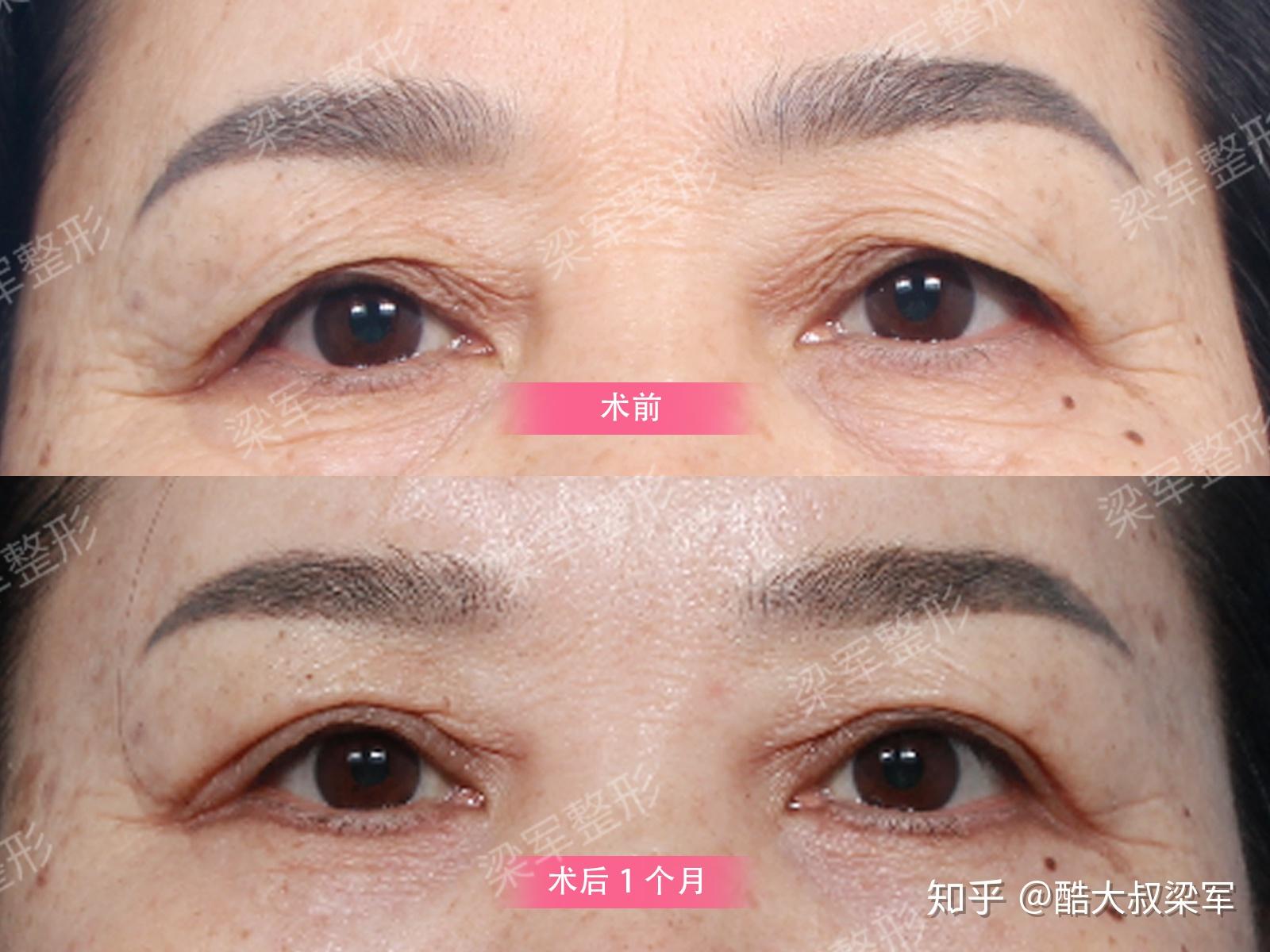 分不清楚提眉切眉有什么区别看这里