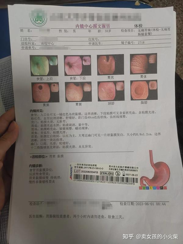 30几岁确诊胃印戒细胞癌,何去何从? - 知乎