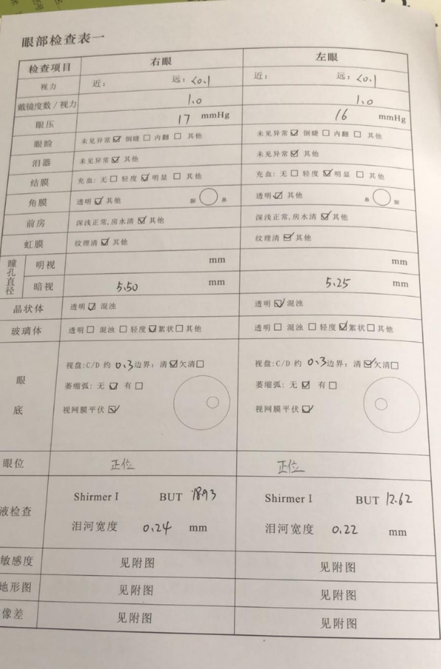 准备我是提前过去做的深度检查,做了一系列的检查:测视力,测眼压,瞳孔