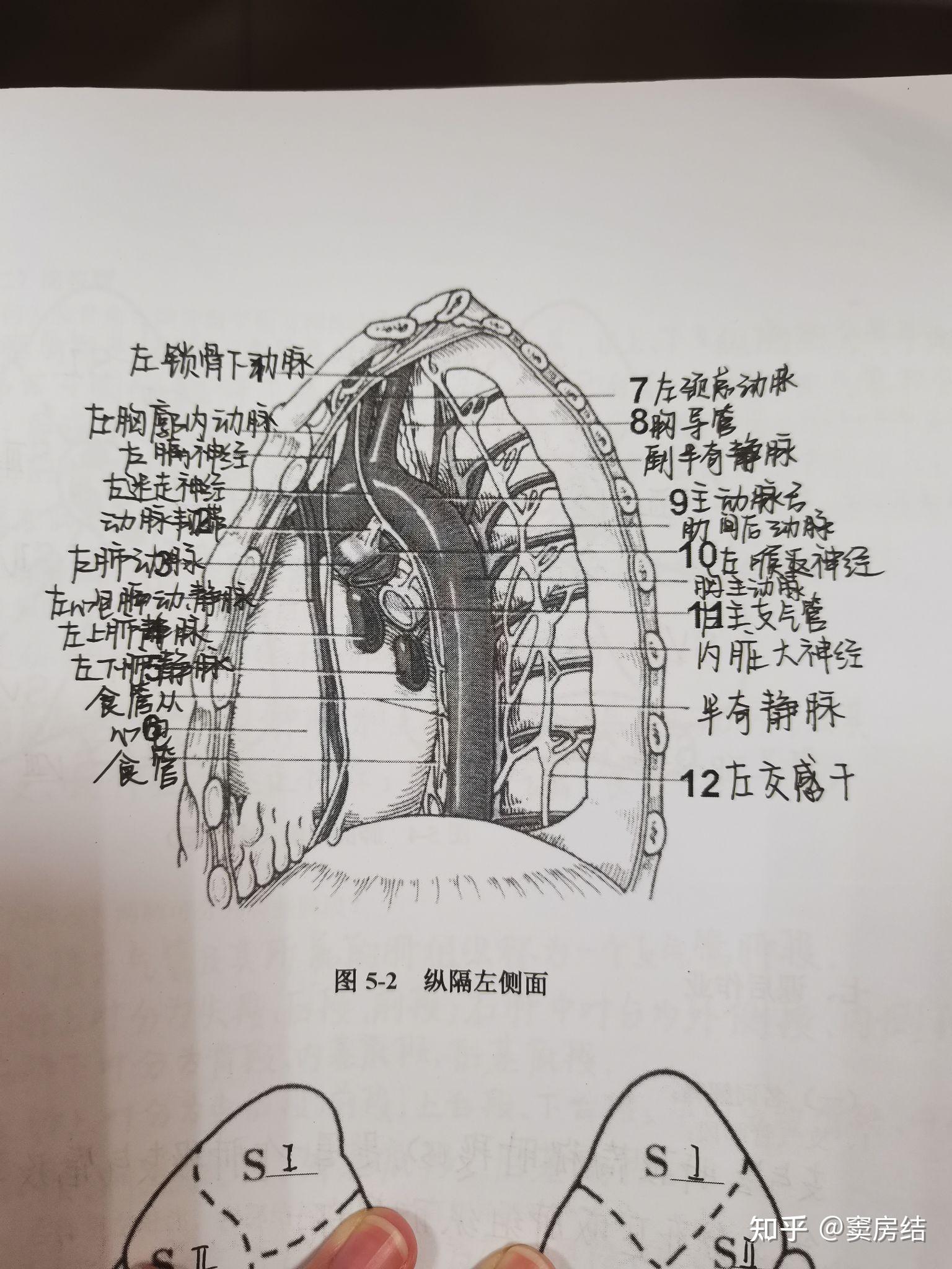 肺部断层 - 知乎