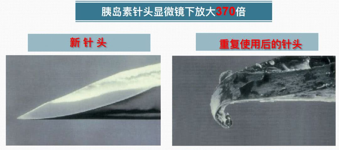使用后)对比对策2:及时更换针头,能节约胰岛素重复使用胰岛素针头,眼