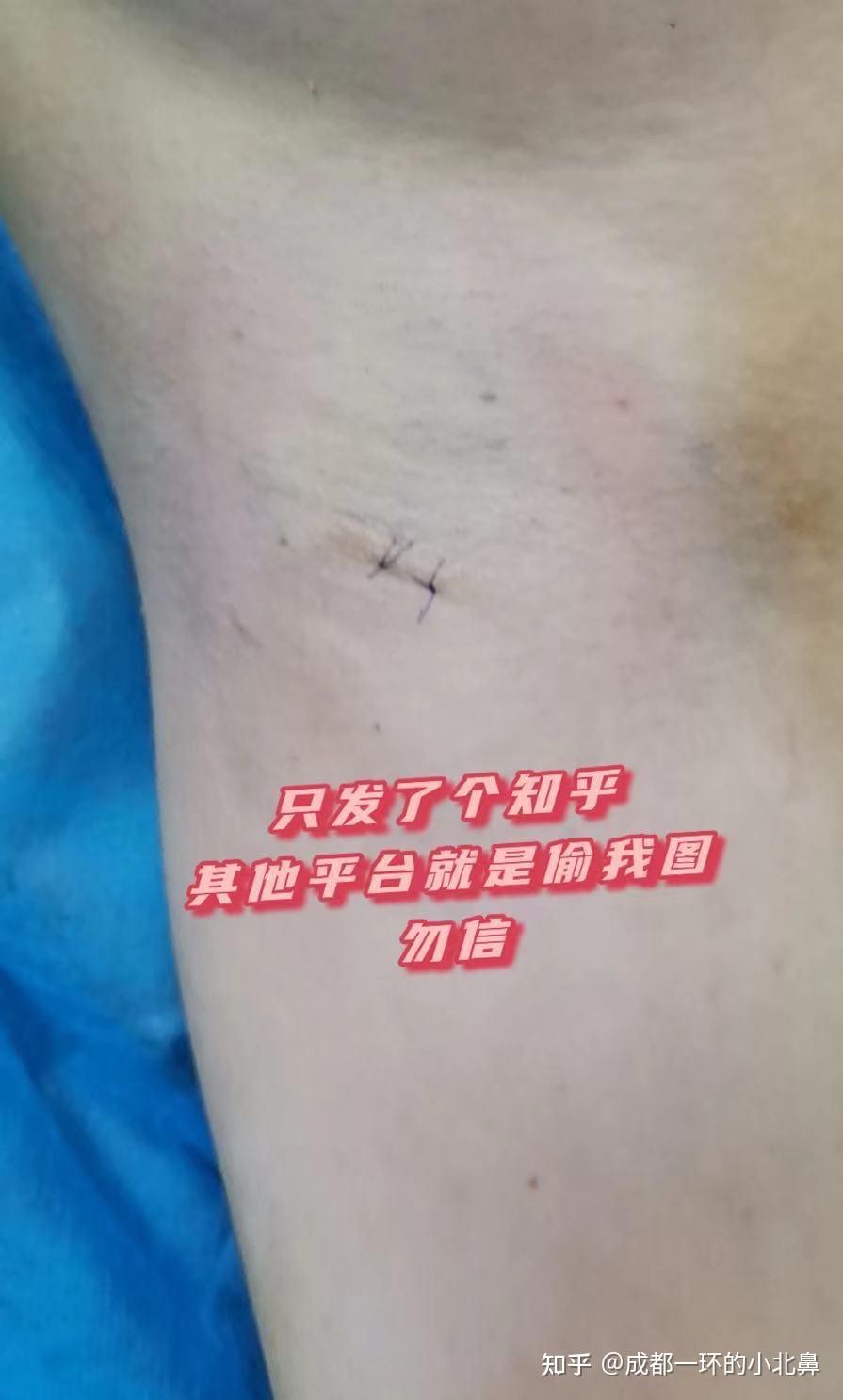 腋秀医疗挂号