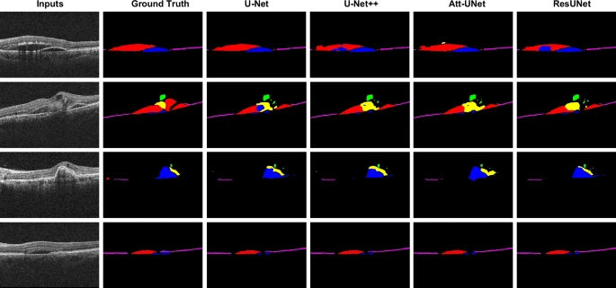 AMD-SD 数据集介绍 - 知乎