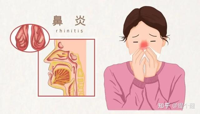 小心,这些颜色的鼻涕是在跟你求救,一定要看懂! - 知乎