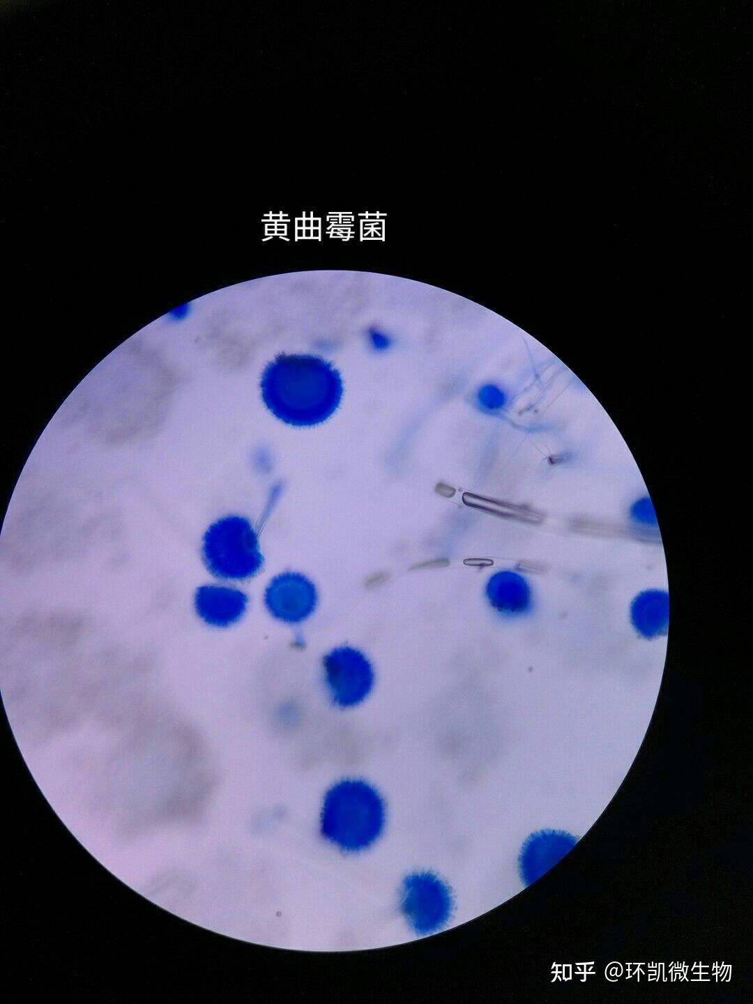 图3-6-26 (未染色)真菌孢子-临床医学-医学