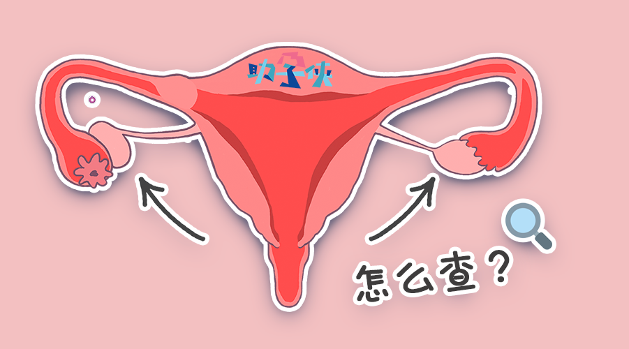 什么时候检查卵巢功能 v2-f7bb99f27caad5a73b63278a5b2e1887_1440w.jpg?source=172ae18b